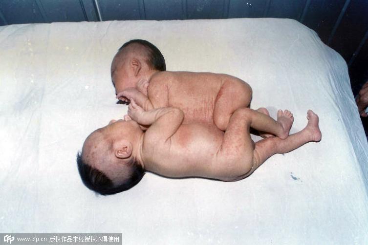 ��(d��ng)����B�w�냺�������Ș� �����ĈD�� 